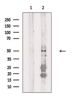 Invitrogen FOXD4L1 Polyclonal Antibody 100 &mu;L | Buy Online | Invitrogen&trade; | Fisher Scientific