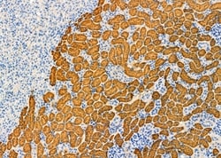 Invitrogen Aldolase B Polyclonal Antibody 100 &mu;L; Unconjugated:Antibodies,