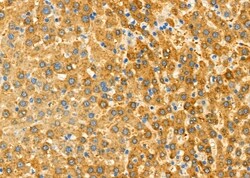 Invitrogen Aldolase B Polyclonal Antibody 100 &mu;L; Unconjugated:Antibodies,