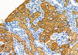 Invitrogen Aldolase B Polyclonal Antibody 100 &mu;L; Unconjugated:Antibodies,