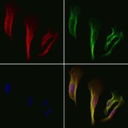 Invitrogen Aldolase B Polyclonal Antibody 100 &mu;L; Unconjugated:Antibodies,