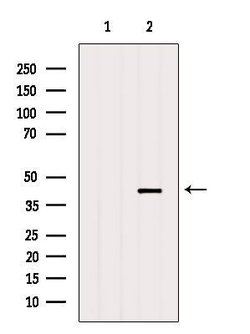 Invitrogen Aldolase B Polyclonal Antibody 100 &mu;L; Unconjugated:Antibodies,