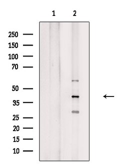 Invitrogen GPS2 Polyclonal Antibody 100 &mu;L | Buy Online | Invitrogen&trade; | Fisher Scientific