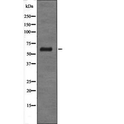 Invitrogen GABRD Polyclonal Antibody 100 &mu;L | Buy Online | Invitrogen&trade; | Fisher Scientific