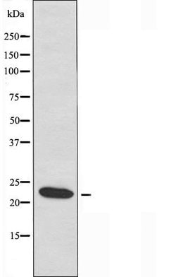 Connexin 25 Polyclonal Antibody, Invitrogen 100 &mu;L; Unconjugated:Antibodies,
