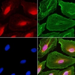 Invitrogen C2orf3 Polyclonal Antibody 100 &mu;L; Unconjugated:Antibodies,