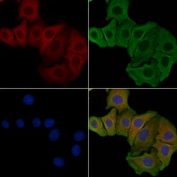 Invitrogen NMDAR2D Polyclonal Antibody 100 &mu;L; Unconjugated:Antibodies,