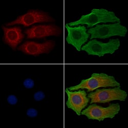 Invitrogen GSTT1 Polyclonal Antibody 100 &mu;L; Unconjugated:Antibodies,