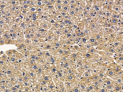 Invitrogen GLRB Polyclonal Antibody 100 &mu;L; Unconjugated:Antibodies,