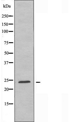 Invitrogen ERAS Polyclonal Antibody 100 &mu;L; Unconjugated:Antibodies,