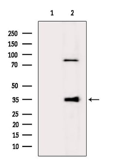 Invitrogen GIMAP5 Polyclonal Antibody 100 &mu;L; Unconjugated:Antibodies,