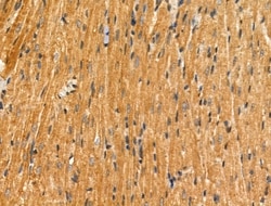 Invitrogen SAR1B Polyclonal Antibody 100 &mu;L; Unconjugated:Antibodies,