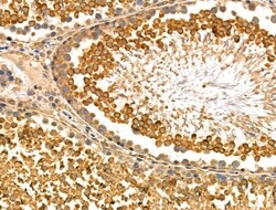 Invitrogen SAR1B Polyclonal Antibody 100 &mu;L; Unconjugated:Antibodies,