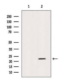 Invitrogen SAR1B Polyclonal Antibody 100 &mu;L; Unconjugated:Antibodies,