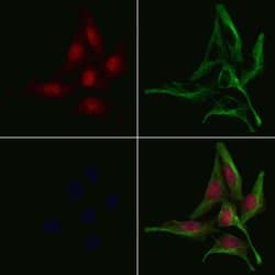 Invitrogen GNAL Polyclonal Antibody 100 &mu;L; Unconjugated:Antibodies,