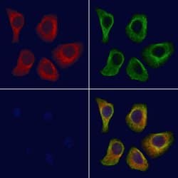 GNL1 Polyclonal Antibody:Antibodies, Polyclonal