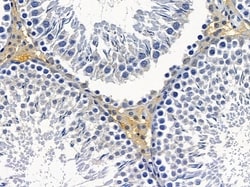 HLA-H Polyclonal Antibody:Antibodies, Polyclonal