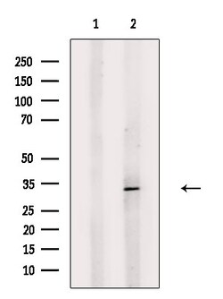 Invitrogen HLA-DOB Polyclonal Antibody 100 &mu;L; Unconjugated:Antibodies,