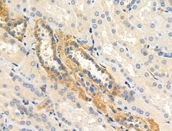 Invitrogen HLA-DPA1 Polyclonal Antibody 100 &mu;L; Unconjugated:Antibodies,