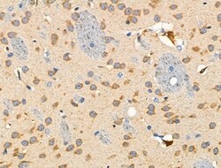 Invitrogen HLA-DPA1 Polyclonal Antibody 100 &mu;L; Unconjugated:Antibodies,