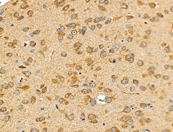 Invitrogen HLA-DPA1 Polyclonal Antibody 100 &mu;L; Unconjugated:Antibodies,