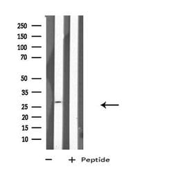 Invitrogen HLA-DPA1 Polyclonal Antibody 100 &mu;L; Unconjugated:Antibodies,