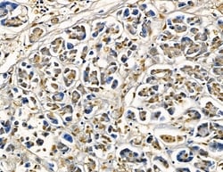 Invitrogen AASDHPPT Polyclonal Antibody 100 &mu;L; Unconjugated:Antibodies,
