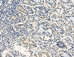 Invitrogen AASDHPPT Polyclonal Antibody 100 &mu;L; Unconjugated:Antibodies,