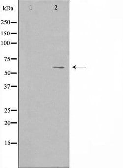 DCT Polyclonal Antibody:Antibodies, Polyclonal