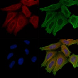 LIPI Polyclonal Antibody:Antibodies, Polyclonal