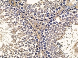 LIPI Polyclonal Antibody:Antibodies, Polyclonal