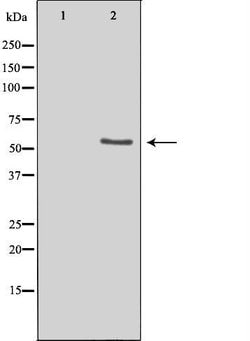 LIPI Polyclonal Antibody:Antibodies, Polyclonal