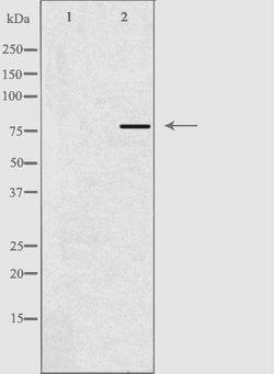 Invitrogen ACSL6 Polyclonal Antibody 100 &mu;L; Unconjugated:Antibodies,