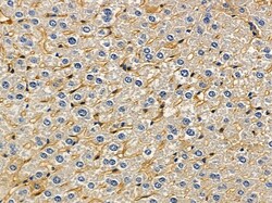 Invitrogen LDLRAD1 Polyclonal Antibody 100 &mu;L; Unconjugated:Antibodies,