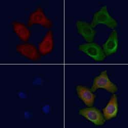 Invitrogen CD206 Polyclonal Antibody 100 &mu;L; Unconjugated:Antibodies,