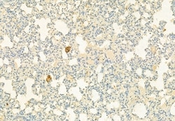 Invitrogen CD206 Polyclonal Antibody 100 &mu;L; Unconjugated:Antibodies,