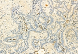 Invitrogen CD206 Polyclonal Antibody 100 &mu;L; Unconjugated:Antibodies,