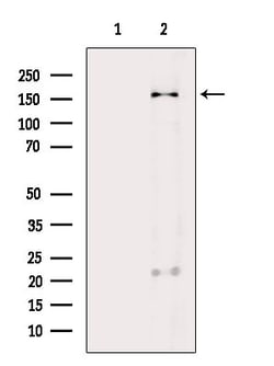 Invitrogen CD206 Polyclonal Antibody 100 &mu;L; Unconjugated:Antibodies,