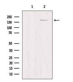 Invitrogen CD206 Polyclonal Antibody 100 &mu;L; Unconjugated:Antibodies,