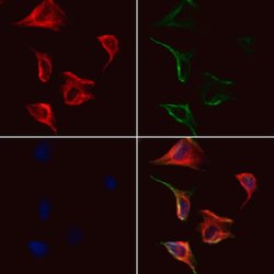 Invitrogen GSDMC Polyclonal Antibody 100 &mu;L; Unconjugated:Antibodies,