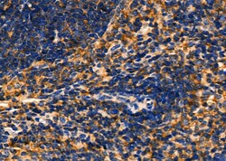 Invitrogen GSDMC Polyclonal Antibody 100 &mu;L; Unconjugated:Antibodies,