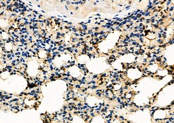 Invitrogen GSDMC Polyclonal Antibody 100 &mu;L; Unconjugated:Antibodies,