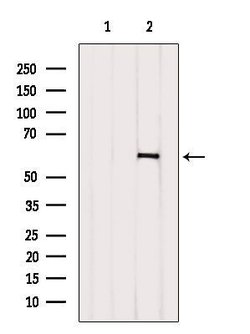 Invitrogen GSDMC Polyclonal Antibody 100 &mu;L; Unconjugated:Antibodies,