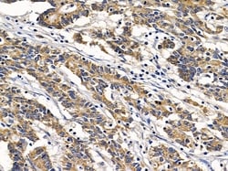 Invitrogen CLNS1A Polyclonal Antibody 100 &mu;L; Unconjugated:Antibodies,
