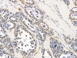 Invitrogen CLNS1A Polyclonal Antibody 100 &mu;L; Unconjugated:Antibodies,