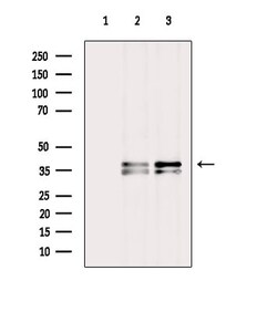 Invitrogen CLNS1A Polyclonal Antibody 100 &mu;L; Unconjugated:Antibodies,