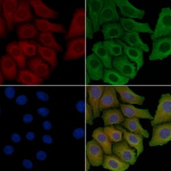 Invitrogen MGST1 Polyclonal Antibody 100 &mu;L; Unconjugated:Antibodies,