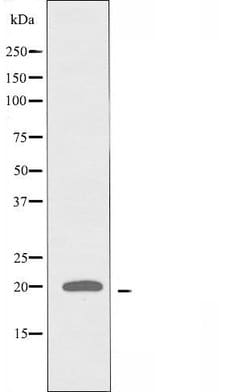 Invitrogen MRPS25 Polyclonal Antibody 100 &mu;L; Unconjugated:Antibodies,