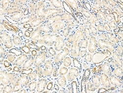 Invitrogen SLC25A21 Polyclonal Antibody 100 &mu;L; Unconjugated:Antibodies,