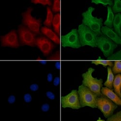 Invitrogen SLC25A11 Polyclonal Antibody 100 &mu;L; Unconjugated:Antibodies,